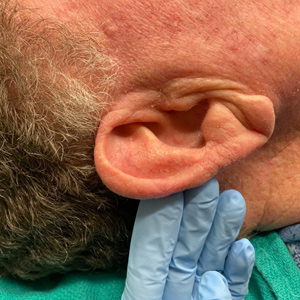 Ear & Neck Img6